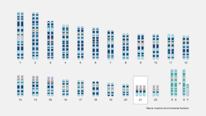 <diagrama-de-los-cromosomas-humanos-en-el-sindrome-de-down>