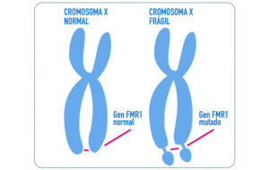 <comparacion-cromosoma-normal-ante-cromosoma-autismo>