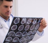 Doctor examining MRI images of patient with multiple sclerosis in clinic